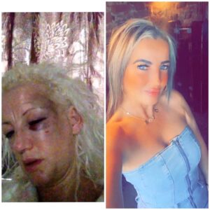 Where to Buy Pain Relief Pills: Potential Benefits of Ibogaine Therapies for Neurodivergence